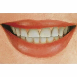 Wenko Zahnweiß-Liquid